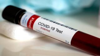 Koronavirüsün yeni bir belirtisi daha tespit edildi: Konjonktivit